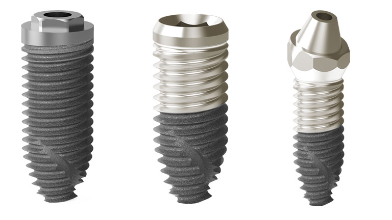 الفرق بين الزراعة السويسرية والألمانية
