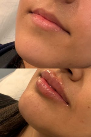 5C16FE1B-9EC3-49DA-AD62-8F7FAECF1F54