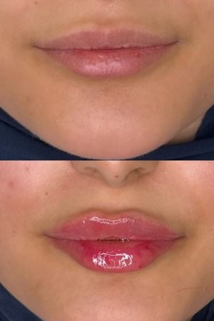 72059A80-4FE2-47EA-9A50-C371A5DD95F1