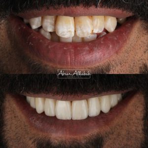 خدمة تقويم الاسنان