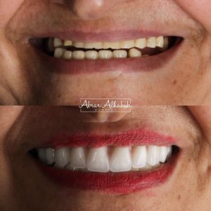 اراء عملائنا