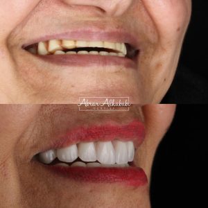 افضل عيادة اسنان في الرياض