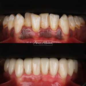 نموذج تقويم الاسنان