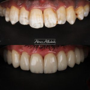 تقويم الاسنان