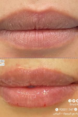 WhatsApp Image 2022-12-08 at 12.37.24 PM