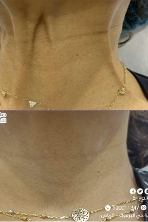 WhatsApp Image 2022-12-08 at 12.37.25 PM