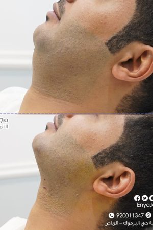 WhatsApp Image 2022-12-08 at 12.37.26 PM