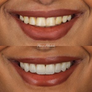 WhatsApp Image 2023-01-08 at 7.19.12 PM (1)