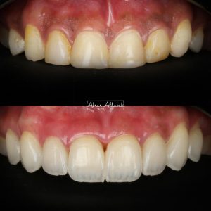 WhatsApp Image 2023-01-08 at 7.19.12 PM (2)