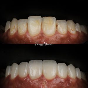 WhatsApp Image 2023-01-08 at 7.19.12 PM (3)